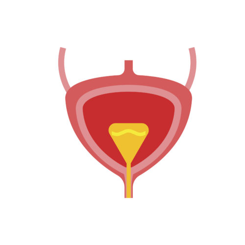 Bladder Cancer: One of the Most Common Aliments Urologists Treat